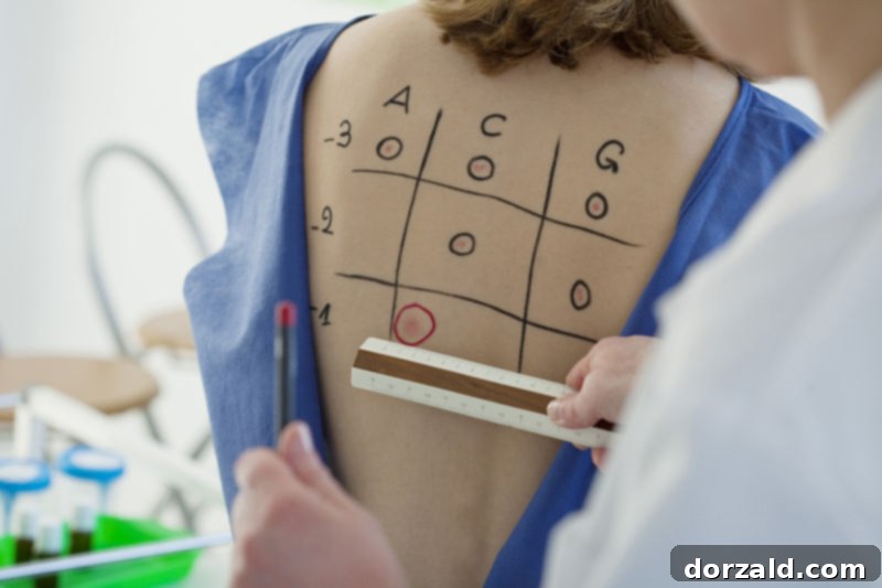 Laktozsuz Hikayem ve Faydalı İpuçları 2 allergy test